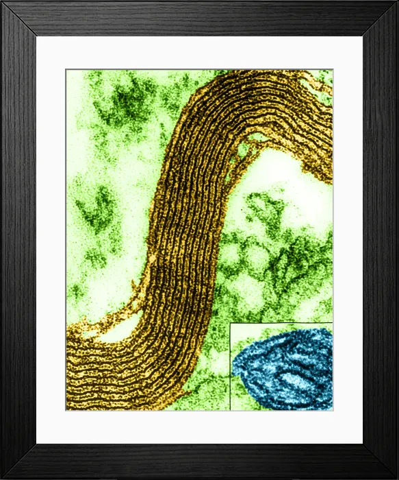 Framed Print : Cell Structure, Myelin Sheath, TEM Framed Print : Cell Structure, Myelin Sheath, TEM