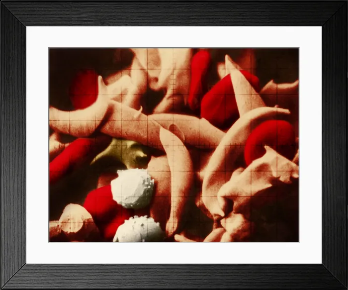 Framed Print : SCD, Sickle-Cell Anemia, under a microscope (SEM) Framed Print : SCD, Sickle-Cell Anemia, under a microscope (SEM)