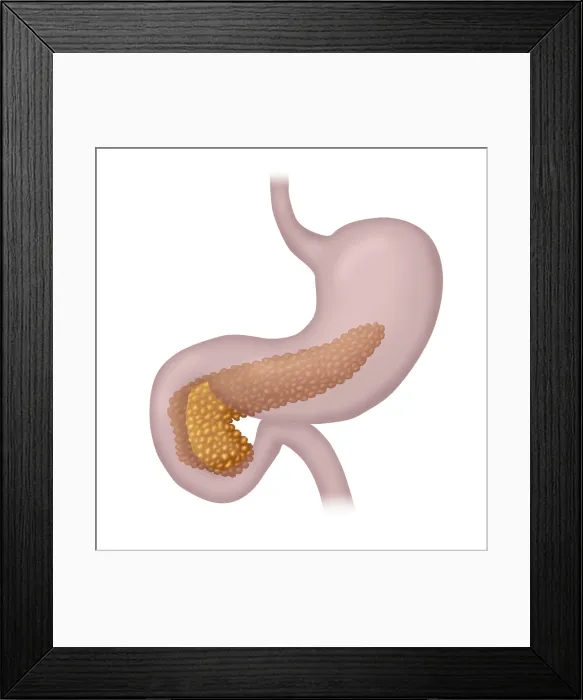 Framed Print : Pancreas. Illustration of a human pancreas within the stomach