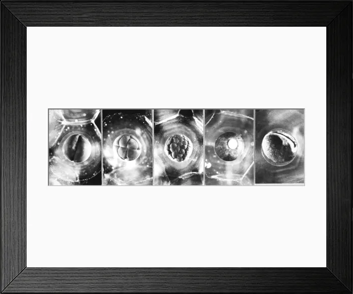 Framed Print : Frog Eggs. Frog eggs (Ovum) in at different stages of growth Framed Print : Frog Eggs. Frog eggs (Ovum) in at different stages of growth