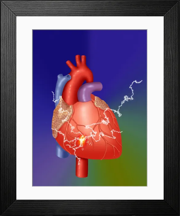Framed Print : Heart Attack