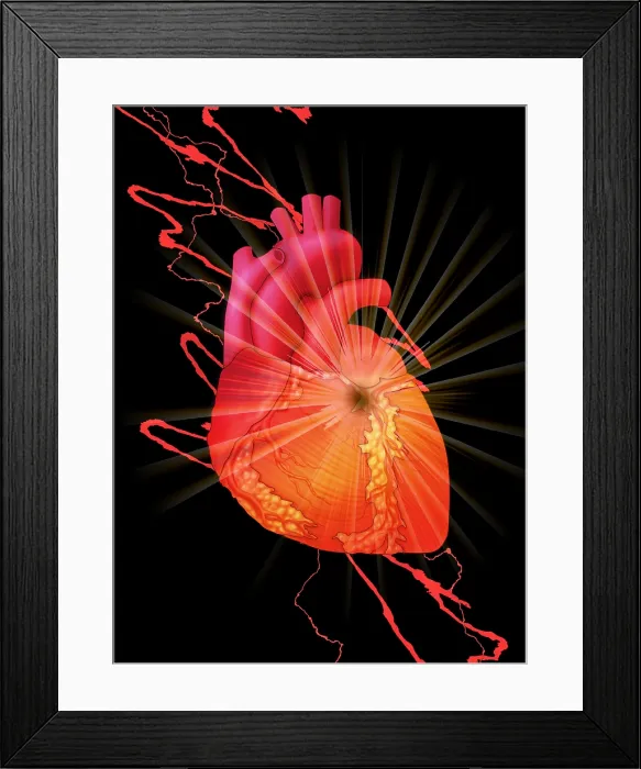 Framed Print : Heart Attack, Conceptual Illustration Framed Print : Heart Attack, Conceptual Illustration