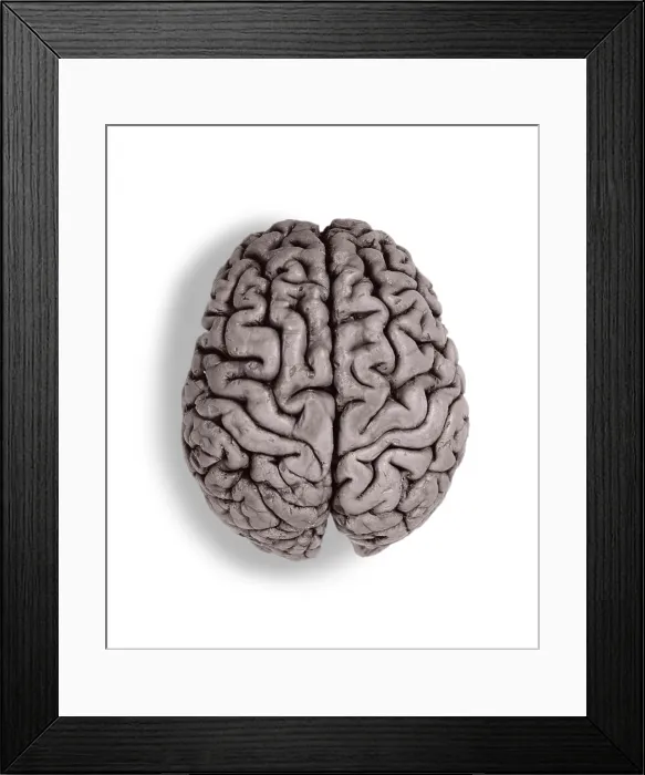 Framed Print : Human Brain, gross specimen Framed Print : Human Brain, gross specimen