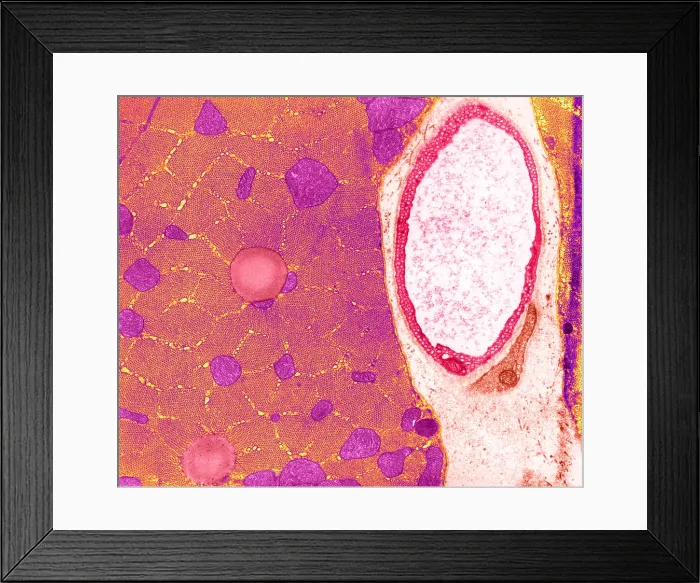 Framed Print : Cat Soleus Muscle, TEM Framed Print : Cat Soleus Muscle, TEM