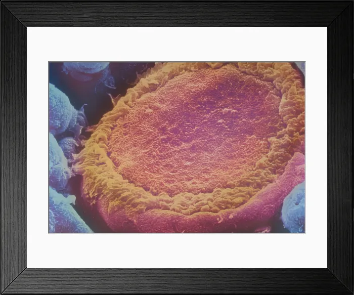 Framed Print : SEM of human taste bud Framed Print : SEM of human taste bud