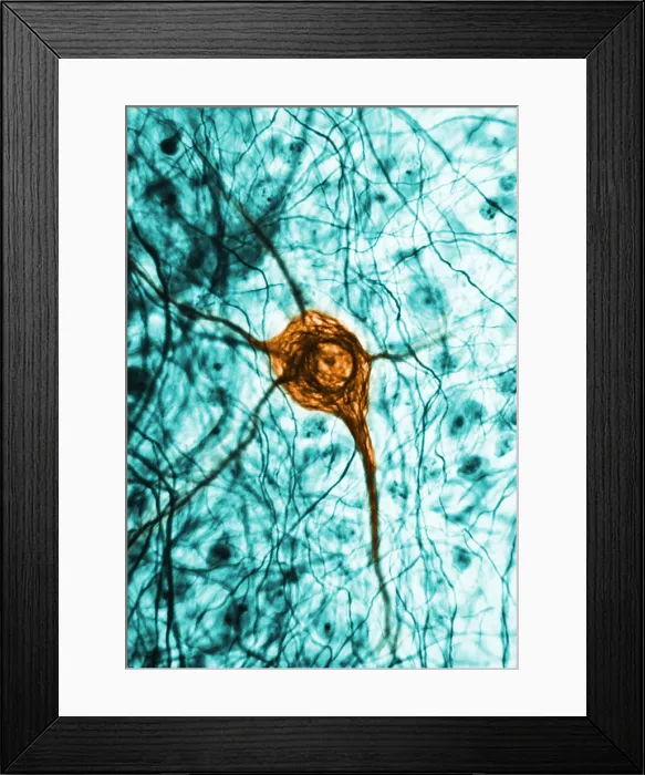 Framed Print : Nervous System, Neuron, TEM Framed Print : Nervous System, Neuron, TEM