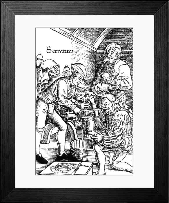 Framed Print : Amputation, 16th Century Framed Print : Amputation, 16th Century
