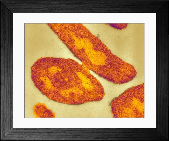 Framed Print : Bacteria, Genetic Recombination, TEM Framed Print : Bacteria, Genetic Recombination, TEM