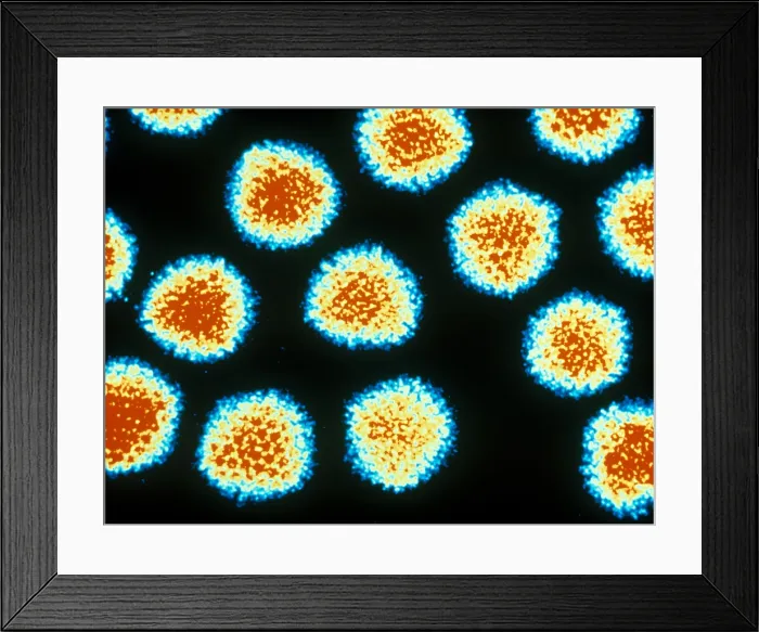Framed Print : Adenovirus, TEM Framed Print : Adenovirus, TEM