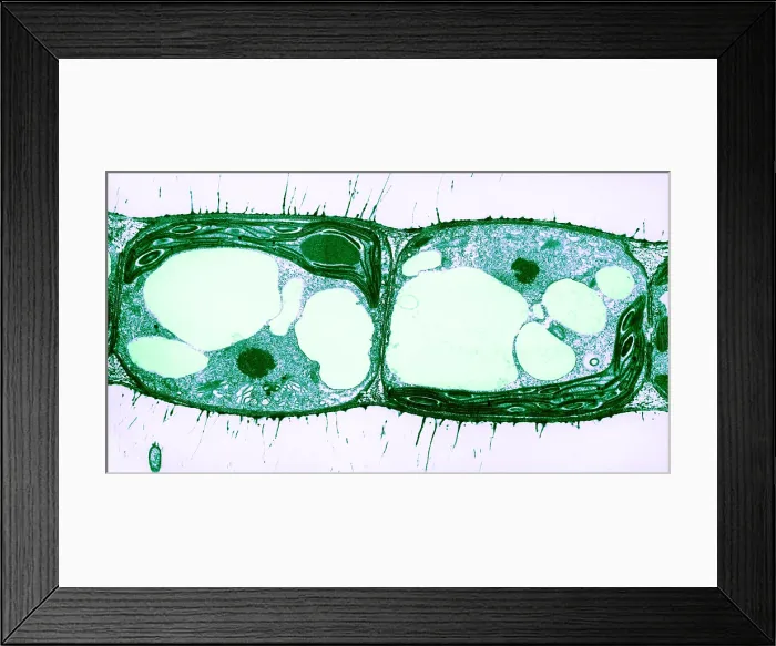 Framed Print : Algae Cell Division, Cylindrocapsa brebissonii Framed Print : Algae Cell Division, Cylindrocapsa brebissonii