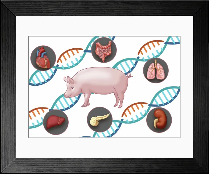 Framed Print : Genetically modified by CRISPR pig and human organs for Xenotransplantation, intestines, lungs, kidney, pancreas, liver and heart, medical illustration Framed Print : Genetically modified by CRISPR pig and human organs for Xenotransplantation, intestines, lungs, kidney, pancreas, liver and heart, medical illustration
