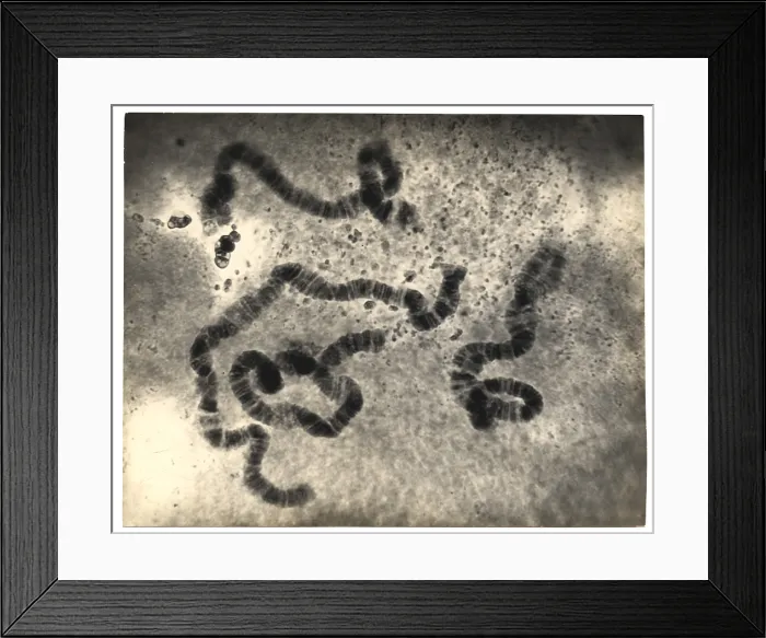 Framed Print : Chromosome Structure, Salivary Glands, Sciara