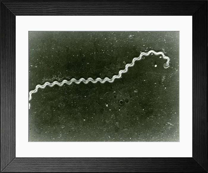 Framed Print : Leptospira Bacteria, under a microscope (SEM) Framed Print : Leptospira Bacteria, under a microscope (SEM)