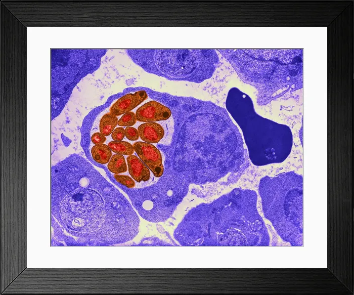 Framed Print : Malaria, Plasmodium cathemerium, TEM Framed Print : Malaria, Plasmodium cathemerium, TEM