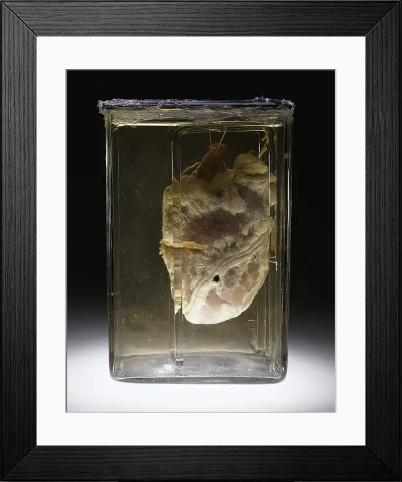 Framed Print : Forensic Evidence, Heart Perforated by Bullet, 1937 Framed Print : Forensic Evidence, Heart Perforated by Bullet, 1937