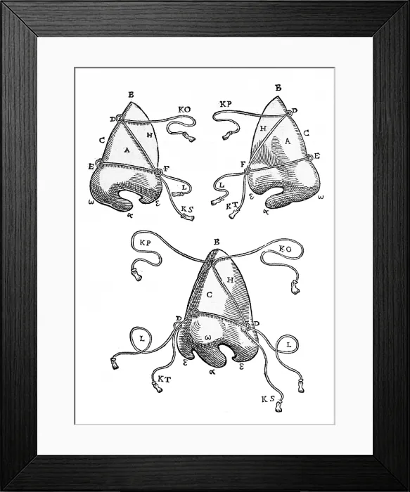 Framed Print : Equipment for One of Tagliacozzi's Rhinoplasty Methods Framed Print : Equipment for One of Tagliacozzi's Rhinoplasty Methods