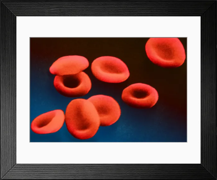 Framed Print : Red Blood Cells, under a microscope (SEM) Framed Print : Red Blood Cells, under a microscope (SEM)