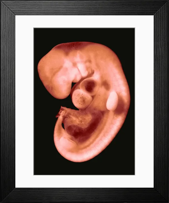 Framed Print : 30 day old human embryo