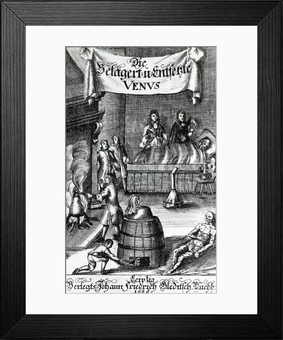 Framed Print : Treatments for Syphilis, 17th century Framed Print : Treatments for Syphilis, 17th century