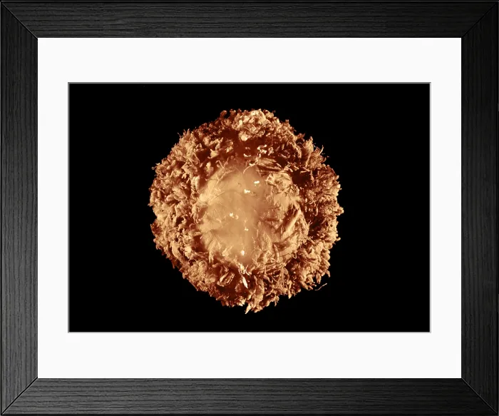 Framed Print : 28 day old human embryo Framed Print : 28 day old human embryo