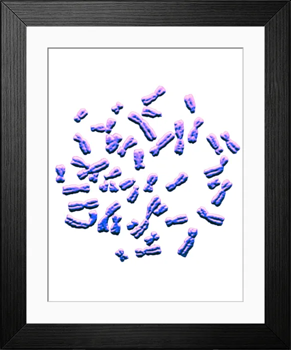 Framed Print : Karyotype, Normal Female Chromosomes Framed Print : Karyotype, Normal Female Chromosomes
