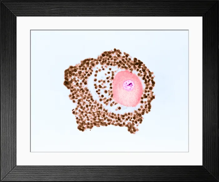 Framed Print : Ovarian egg Framed Print : Ovarian egg
