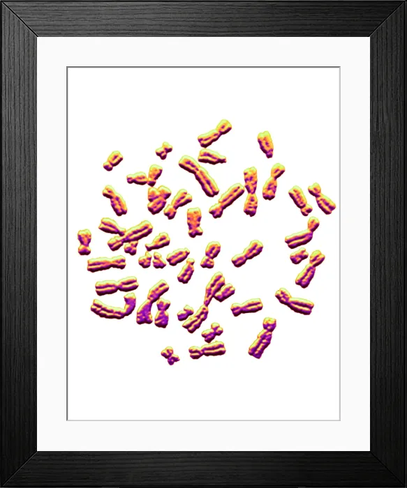 Framed Print : Karyotype, Normal Female Chromosomes Framed Print : Karyotype, Normal Female Chromosomes