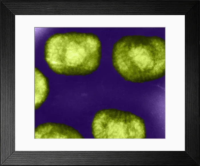 Framed Print : Vaccinia Virus, Eradicated Smallpox, TEM