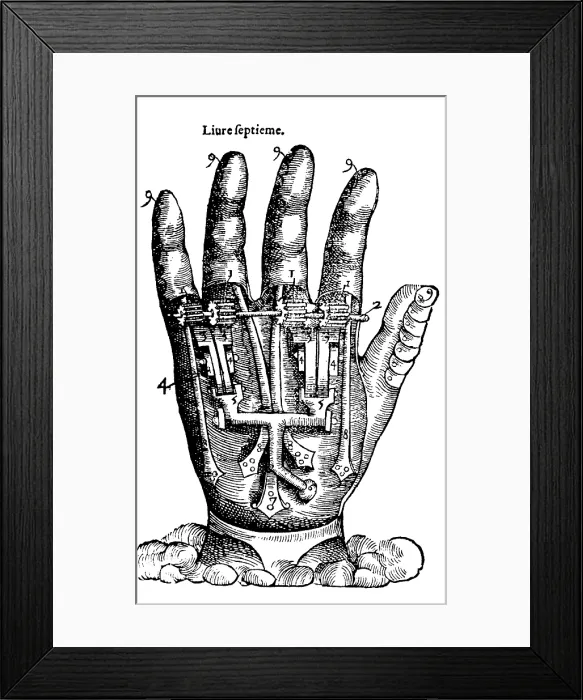 Framed Print : Artificial Hand Designed by Ambroise Pare, 1564 Framed Print : Artificial Hand Designed by Ambroise Pare, 1564