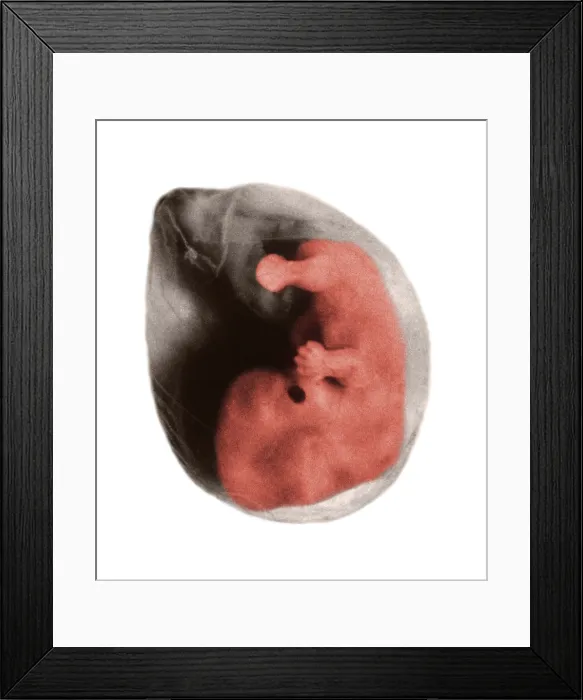 Framed Print : Human Embryo, gross specimen Framed Print : Human Embryo, gross specimen