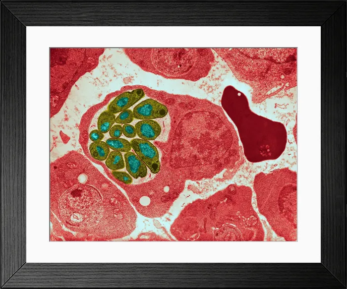 Framed Print : Malaria parasite, Plasmodium cathemerium, inside a blood cell, under an electron microscope, TEM Framed Print : Malaria parasite, Plasmodium cathemerium, inside a blood cell, under an electron microscope, TEM
