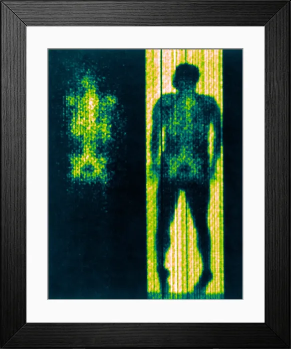 Framed Print : Distribution of Red-Cell-Forming Tissue Framed Print : Distribution of Red-Cell-Forming Tissue