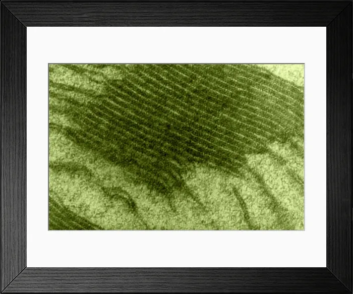Framed Print : Chloroplast, TEM Framed Print : Chloroplast, TEM
