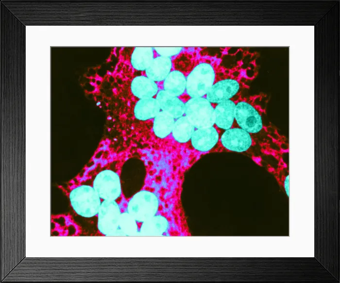 Framed Print : MeV, Measles Virus, TEM