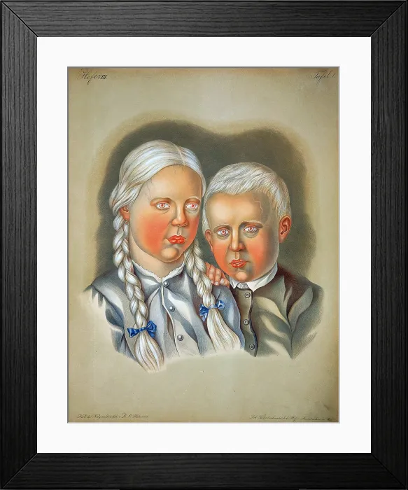 Framed Print : Albino Children, 19th Century Framed Print : Albino Children, 19th Century