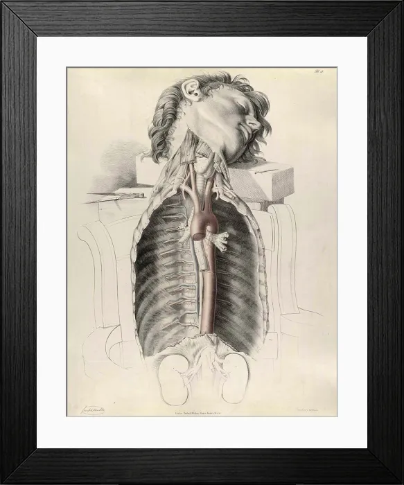 Framed Print : Historical Anatomical Illustration Framed Print : Historical Anatomical Illustration