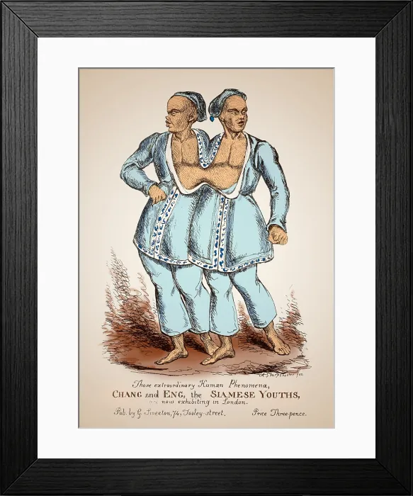 Framed Print : Chang and Eng Bunker, Siamese Twins