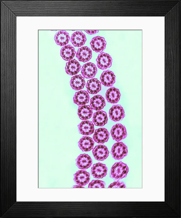 Framed Print : Cilia from Ciliates (TEM)