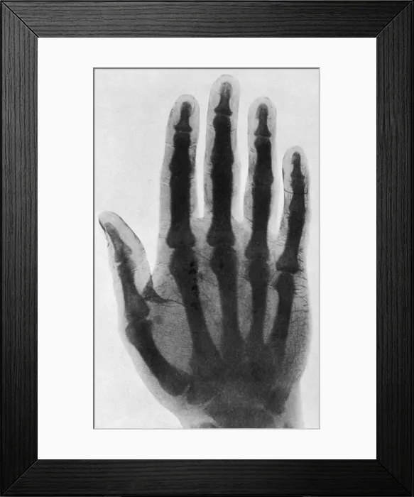 Framed Print : Early X-ray Framed Print : Early X-ray