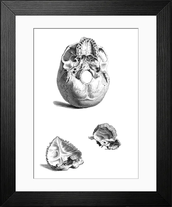 Framed Print : William Cheselden, 'Osteographia', 1733 Framed Print : William Cheselden, 'Osteographia', 1733