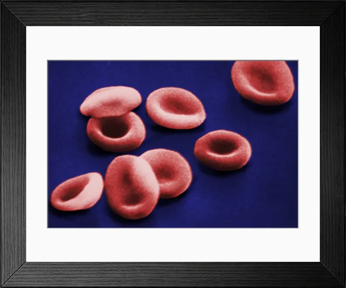Framed Print : Red Blood Cells, under a microscope (SEM) Framed Print : Red Blood Cells, under a microscope (SEM)