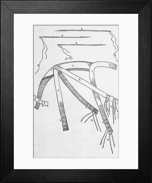 Framed Print : Equipment for One of Tagliacozzi's Rhinoplasty Methods Framed Print : Equipment for One of Tagliacozzi's Rhinoplasty Methods