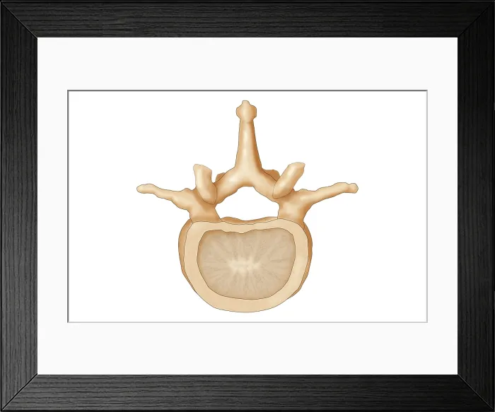 Framed Print : Lumbar Vertebra Framed Print : Lumbar Vertebra