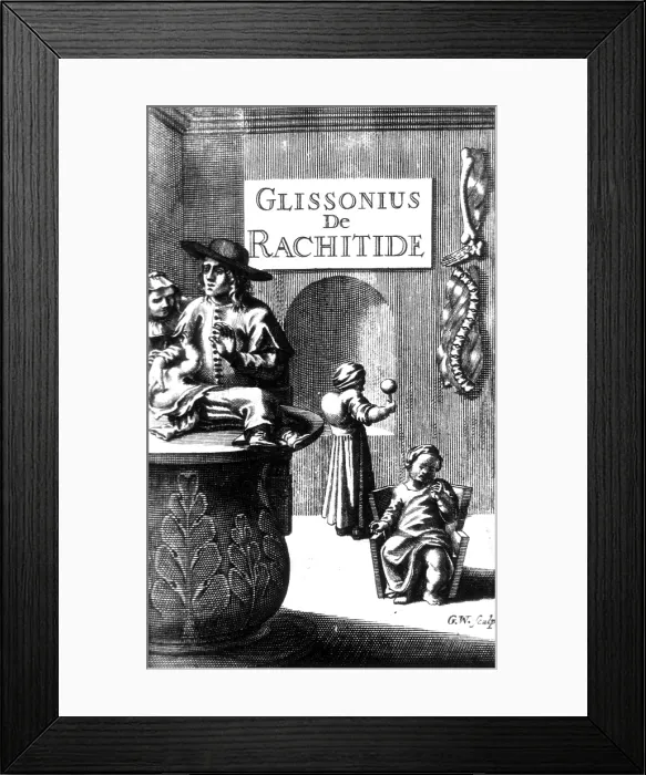 Framed Print : Francis Glisson, English Physician and Anatomist Framed Print : Francis Glisson, English Physician and Anatomist