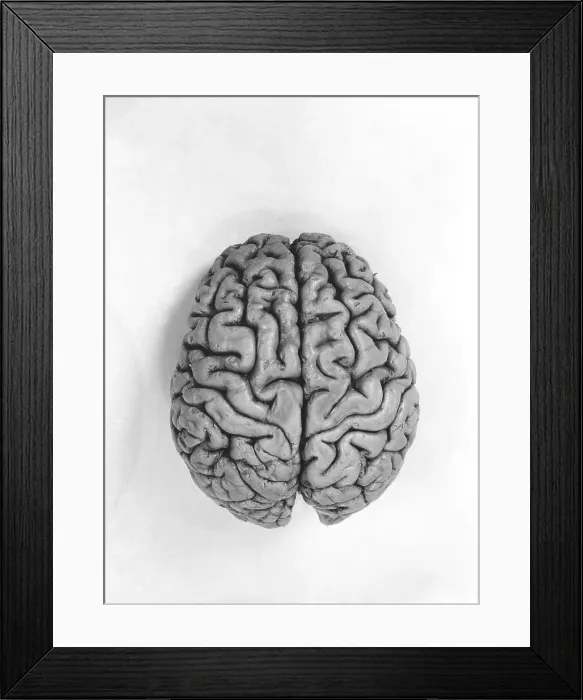 Framed Print : Human Brain Framed Print : Human Brain