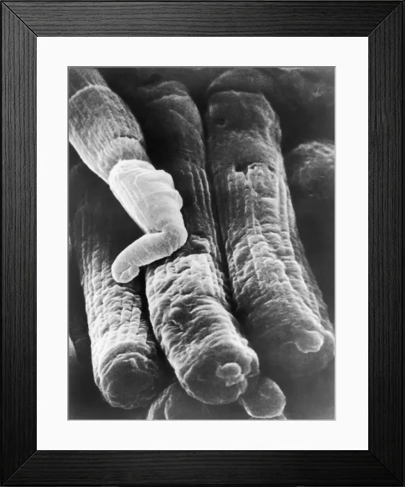 Framed Print : Rods and Cones, under a microscope (SEM)