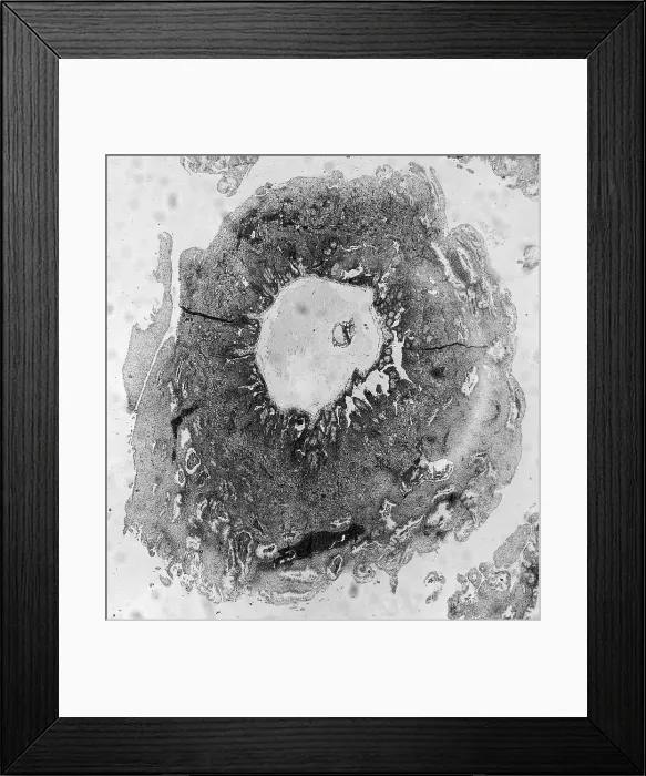 Framed Print : Human Reproduction, Ovum, TEM Framed Print : Human Reproduction, Ovum, TEM