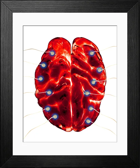 Framed Print : Brain EEG. Illustration of a brain undergoing an EEG (electroencephalogram) Framed Print : Brain EEG. Illustration of a brain undergoing an EEG (electroencephalogram)