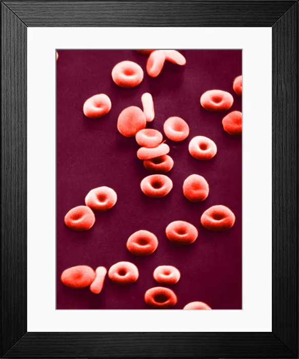 Framed Print : Red Blood Cells, under a microscope (SEM) Framed Print : Red Blood Cells, under a microscope (SEM)