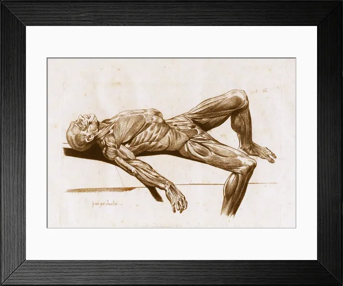 Framed Print : A flayed cadaver Framed Print : A flayed cadaver